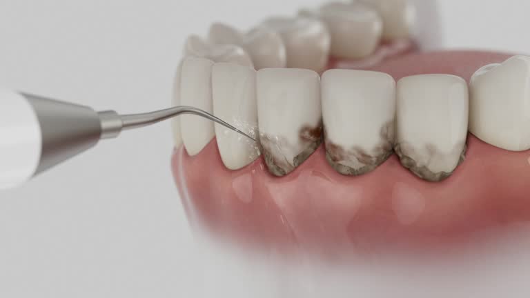 Reliable Dental contractor in Laurence Harbor, NJ by Dentist Open Now